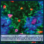 KESLATM - Immunhistochemistry